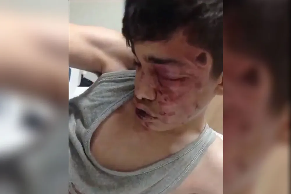 Suriyeli çocuğu darp eden şahıslar tutuklandı