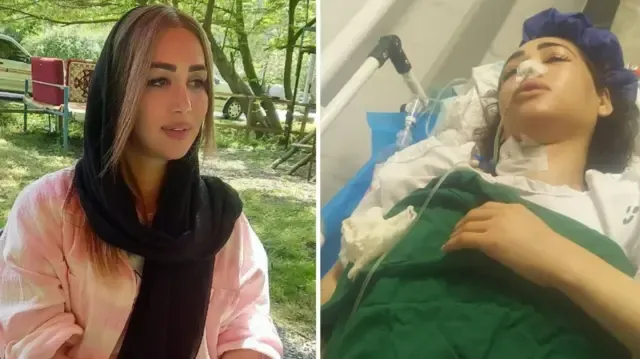 İran’da Güney Azerbaycan Türkü Kadına Polis Şiddeti