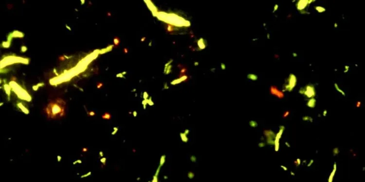 İnsan beyninde ilk kez mikroplastik tespit edildi