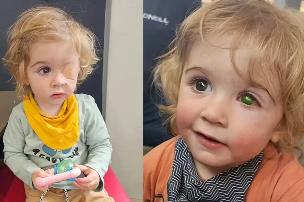 Masum bir öpücük 2 yaşındaki çocuğu kör etti