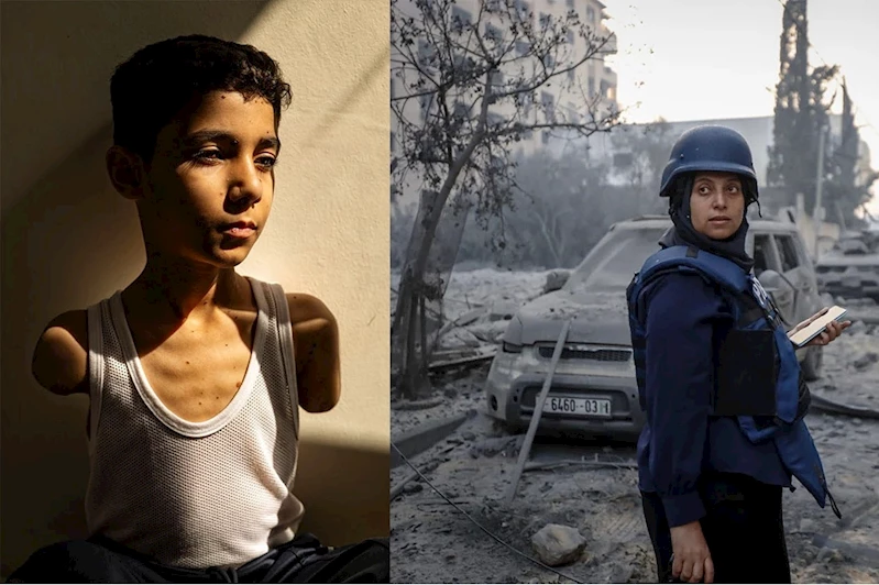 Kollarını kaybeden Filistinli çocuğun fotoğrafı dünyada birinci oldu