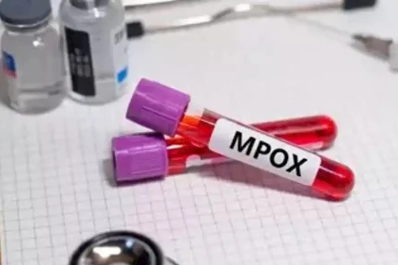 Zambiya’da maymun çiçeği vakası 36’ya yükseldi