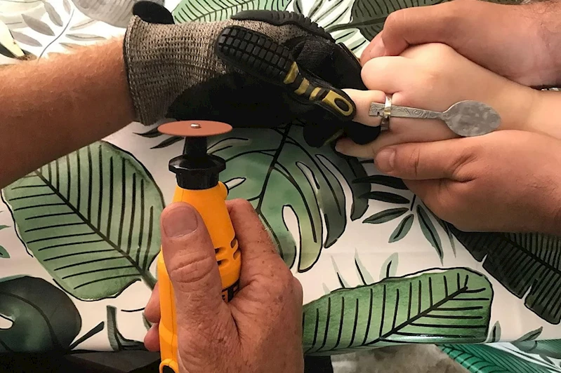 Parmağına sıkışan yüzük itfaiye ekiplerinin müdahalesiyle çıkarıldı