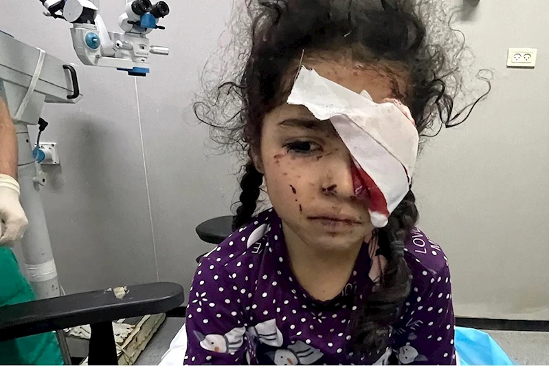 Gazze’de işgal saldırılarında 1.500 kişi görme yetisini kaybetti