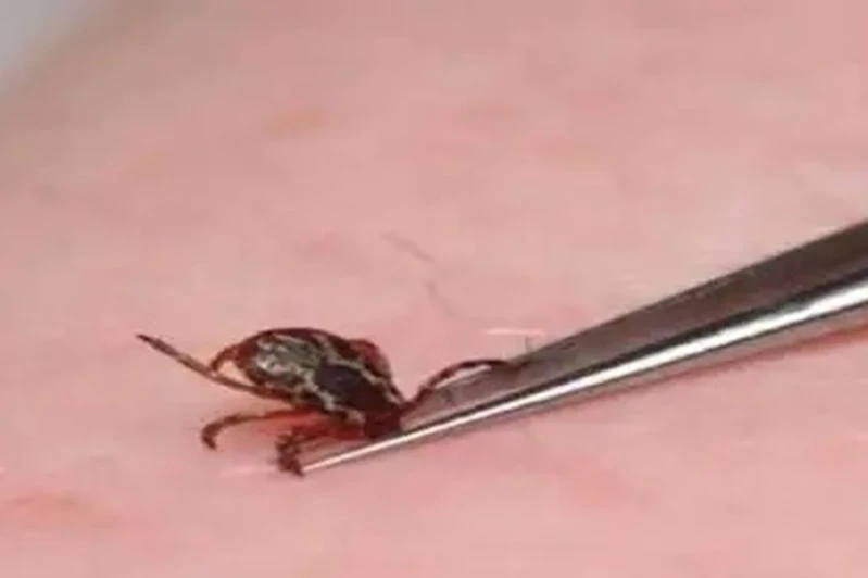 Sivas’ta vücuduna kene yapışan bir kişi hayatını kaybetti