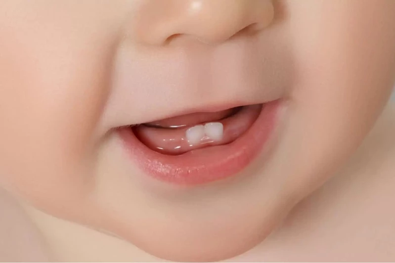 Diş çıkarma döneminde dikkat edilmesi gerekenler