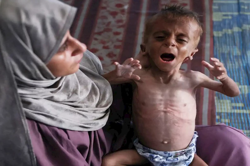 Yerel ve uluslararası kuruluşlar uyardı: Gazze’de açlık toplu kıyım aşamasında