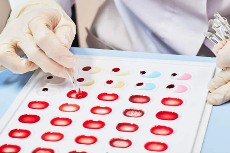 Hindistanlı bir kadında dünyada daha önce görülmemiş bir kan grubu tespit edildi