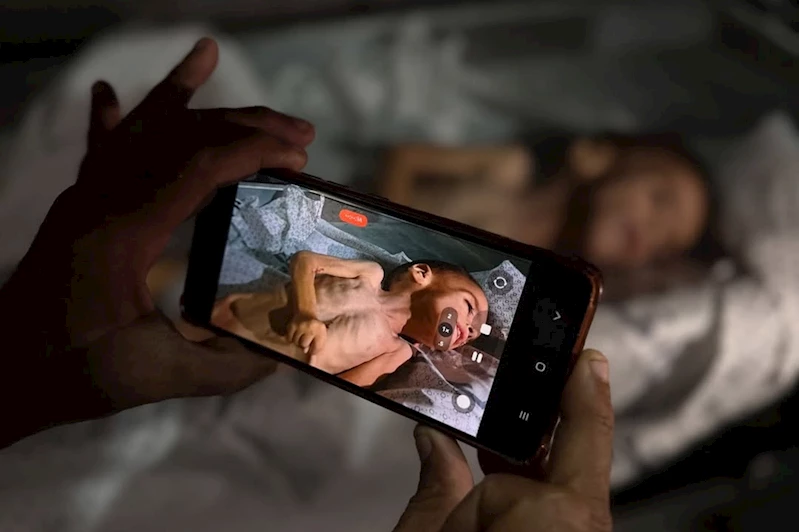 Gazze’de 4 kişi daha açlıktan can verdi!