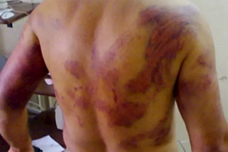 Mahmud Abbas yönetimi cezaevindeki direnişçilere işkence ediyor