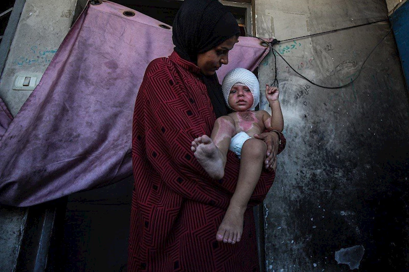 Gazze’de işgal saldırılarında yaralanan bebekler tedavi edilemiyor