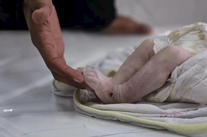 Gazze’de son 24 saatte açlıktan 7 Filistinli şehid oldu