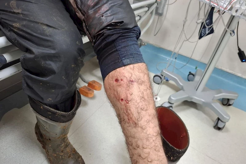 Veteriner hekim aşılama sırasında köpek saldırısına uğradı