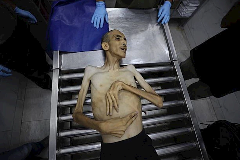 Gazze’de açlıktan ölümler yürek burkuyor