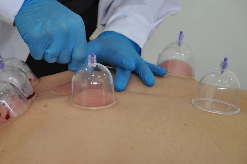 Hacamat ilaçların yerini alabilir mi? GETAT Uzmanı Doktor Ayral anlattı