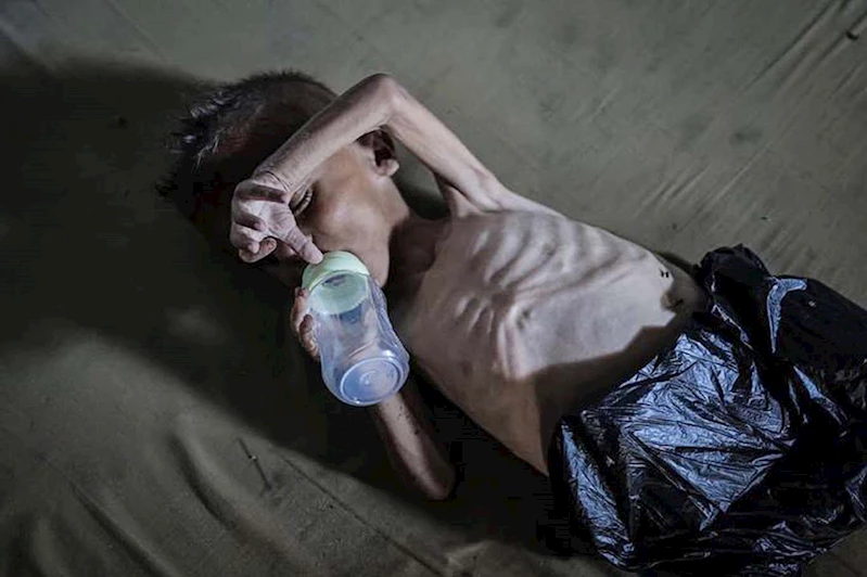 Gazze Sağlık Bakanlığı’ndan kritik uyarı: Çocuklarda artan felç ve Guillain-Barré sendromu vakaları