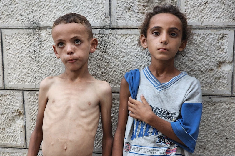 Gazzeliler açlık nedeniyle hayatını kaybediyor: 5 şehit