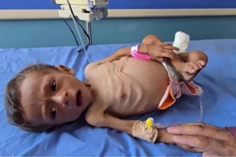 Gazze’de ağustos ayında açlıktan 185 kişi şehit oldu