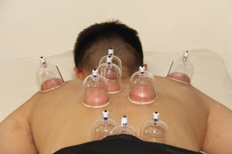 Şifa geleneğinde özel tarih: 9 Eylül Altın Hacamat Günü