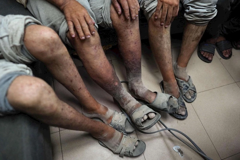 İşgal rejiminden Filistinli esirlere sistematik işkence